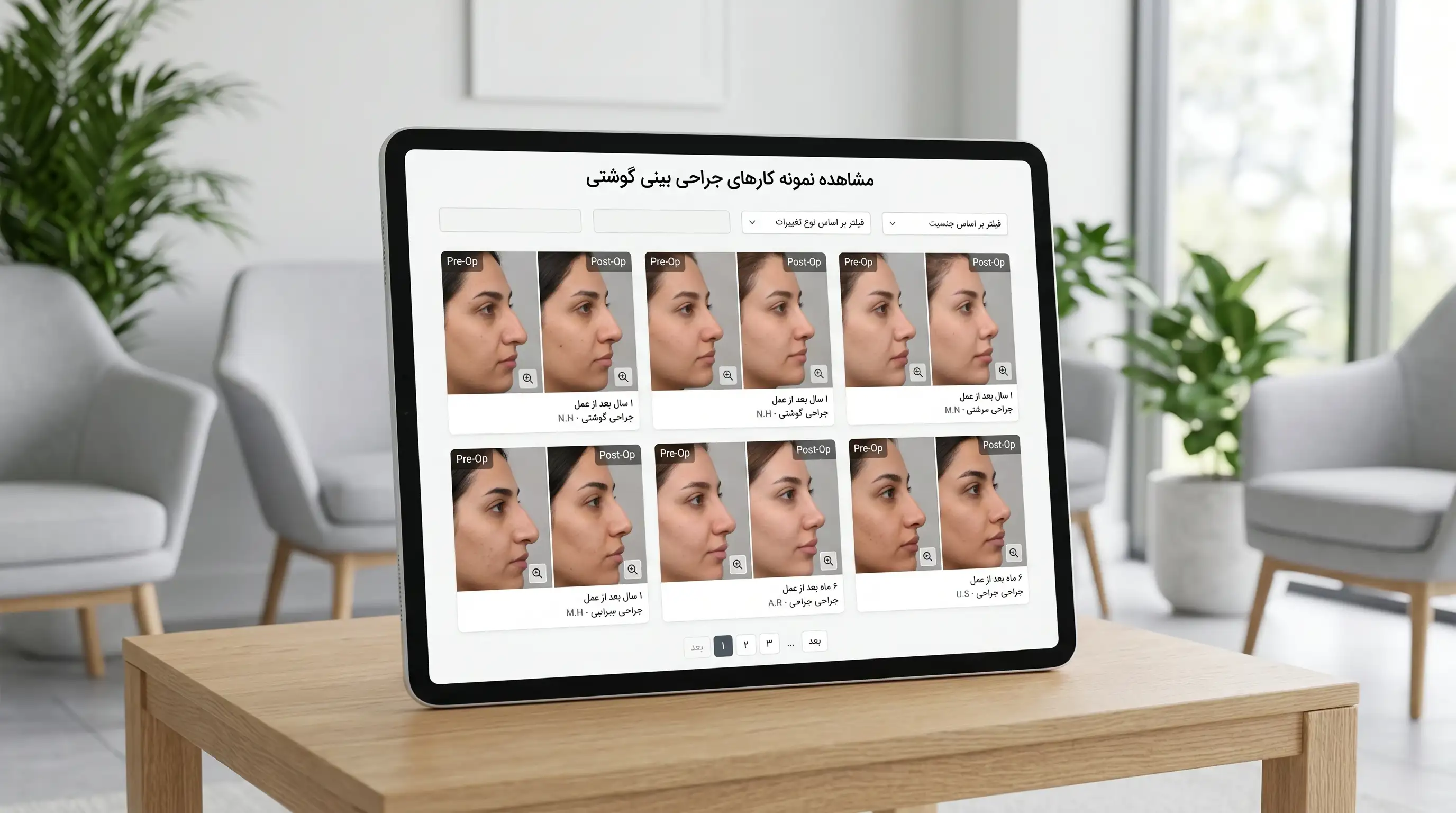 عکس قبل و بعد عمل بینی گوشتی، چه نتیجهای واقعبینانه است؟