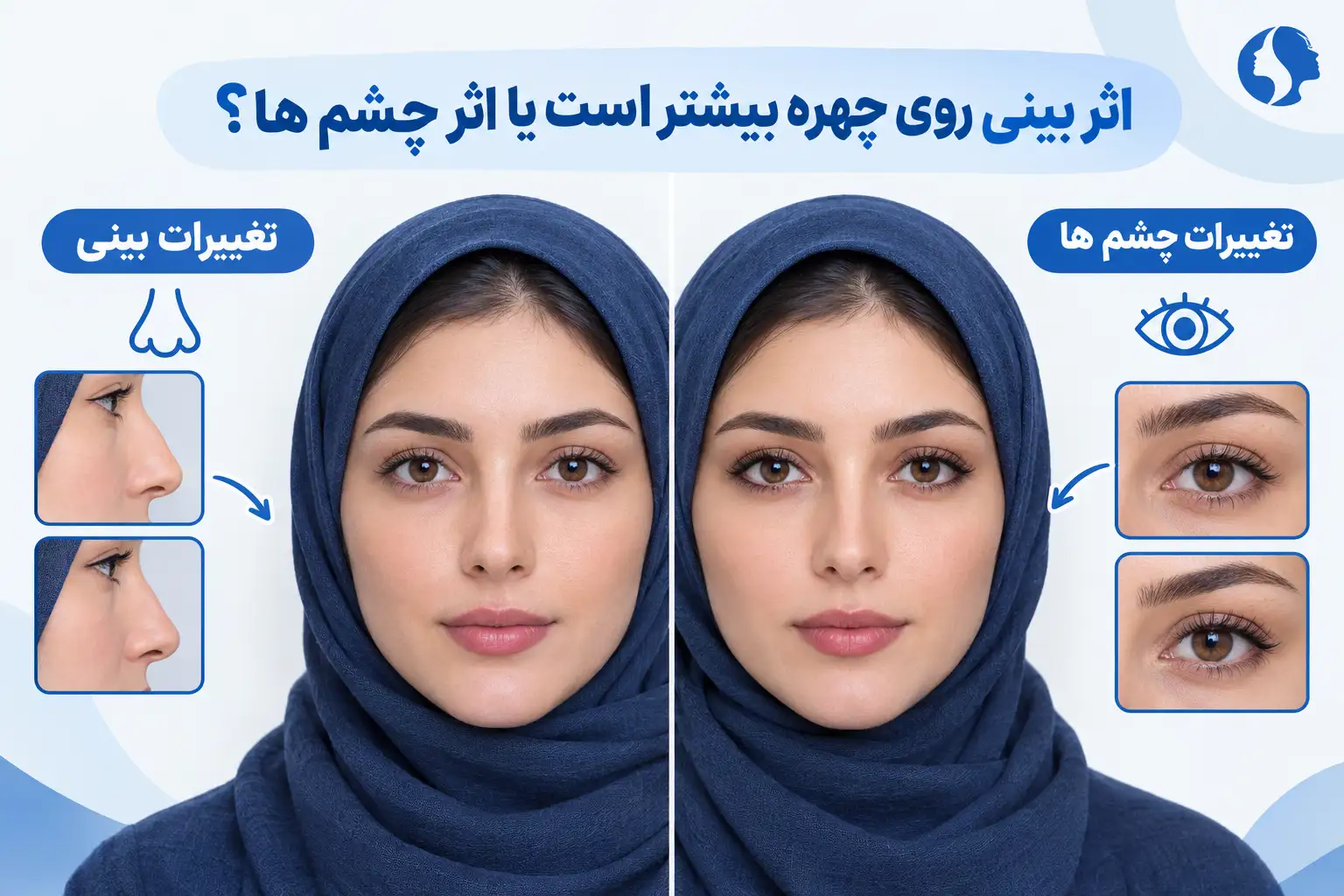 اثر بینی روی چهره بیشتر است یا اثر چشم ها؟